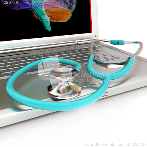 Image of Laptop, brain and Stethoscope. 3d illustration. Anaglyph. View w