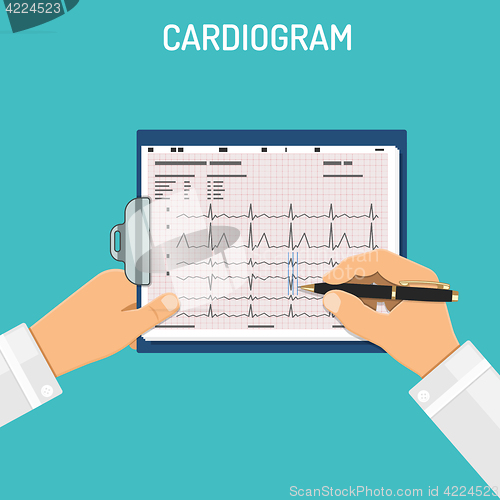 Image of Cardiogram on clipboard in hands of doctor