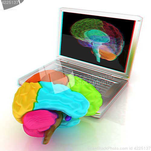 Image of creative three-dimensional model of real human brain and scan on