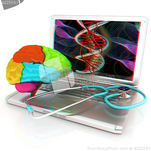 Image of Laptop, brain and Stethoscope. 3d illustration. Anaglyph. View w