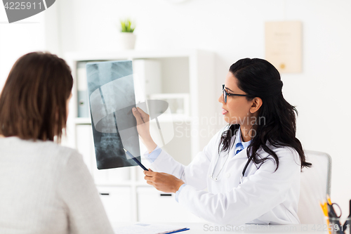 Image of doctor and patient with spine x-ray at hospital