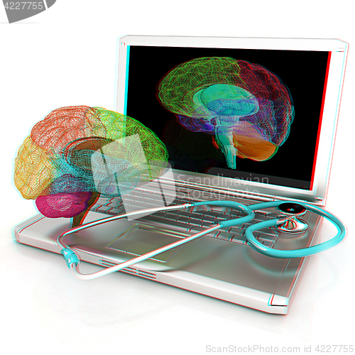 Image of Laptop, brain and Stethoscope. 3d illustration. Anaglyph. View w