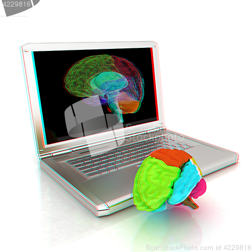 Image of creative three-dimensional model of real human brain and scan on