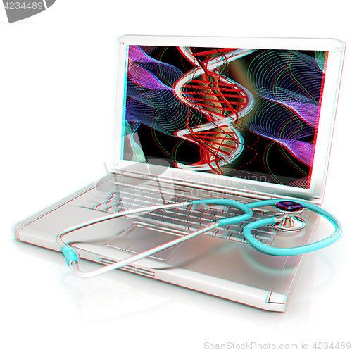 Image of silver laptop diagnosis with stethoscope. 3D illustration. Anagl