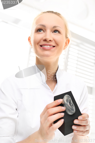 Image of Plastic ears. Female surgeon with silicone cast of the ear.