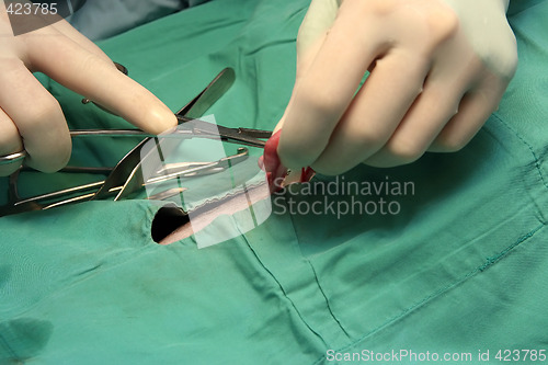 Image of Surgical procedure