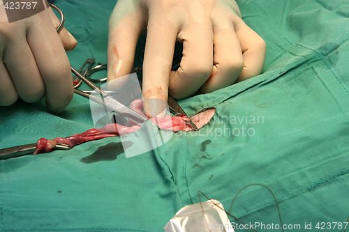 Image of Surgical procedure