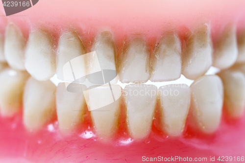 Image of dirty dental plate