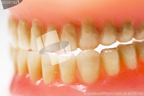 Image of dirty dental plate