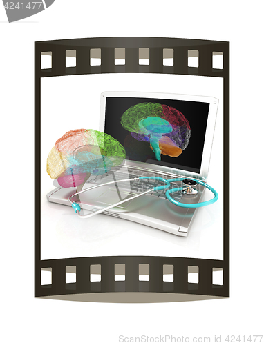 Image of Laptop, brain and Stethoscope. 3d illustration. The film strip