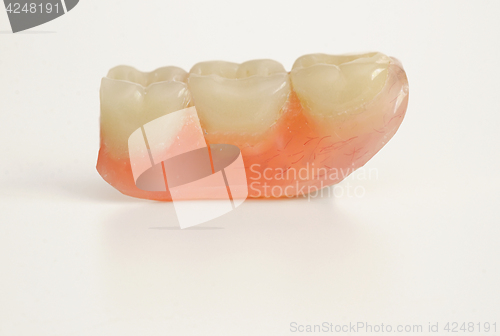 Image of Three prosthetic teeth 