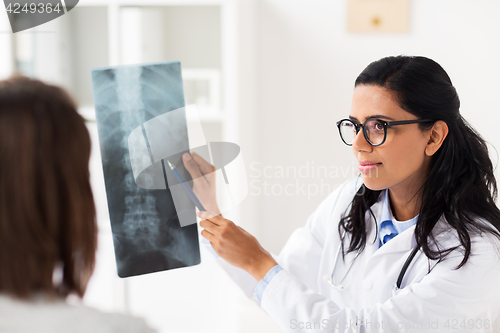 Image of doctor and patient with spine x-ray at hospital