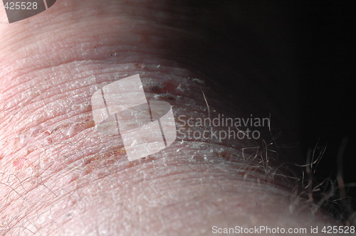 Image of Skin problem