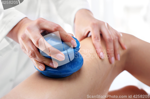 Image of Anticellulite massage Chinese cupping.