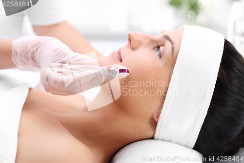 Image of Roller microneedle mesotherapy in the wellness clinic.