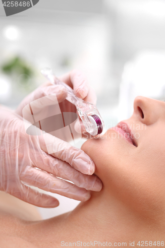 Image of Mesotherapy microneedle, the woman at the beautician