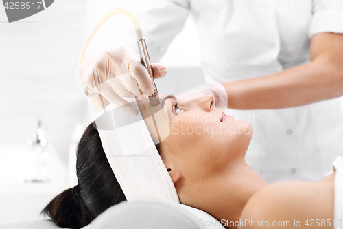 Image of Diamond microdermabrasion, peeling cosmetic