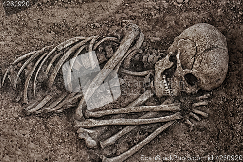 Image of very old human skull