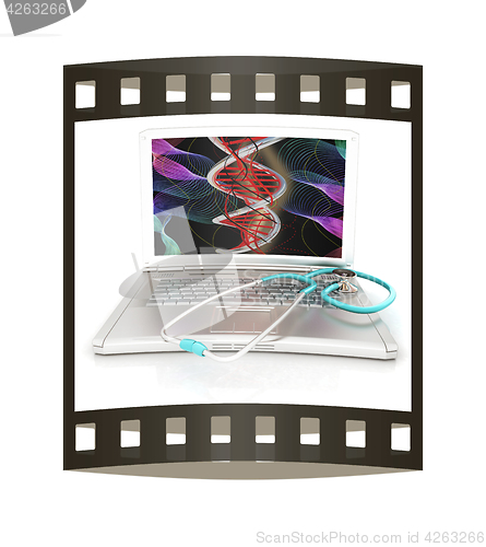 Image of silver laptop diagnosis with stethoscope. 3D illustration. The f