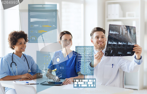 Image of group of happy doctors looking at x-ray image