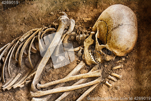 Image of old human bones