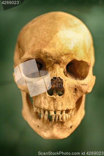 Image of old human skull