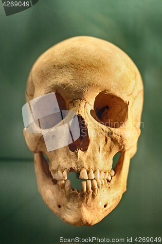 Image of old human skull