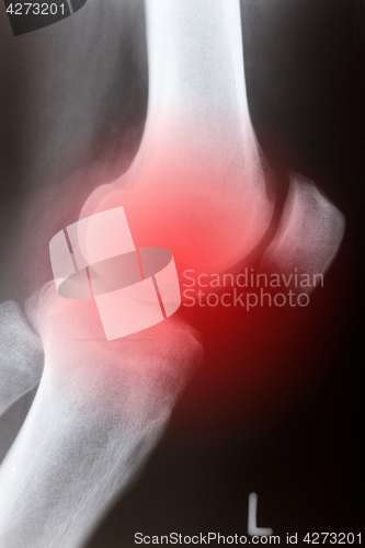 Image of Human knee sidelong