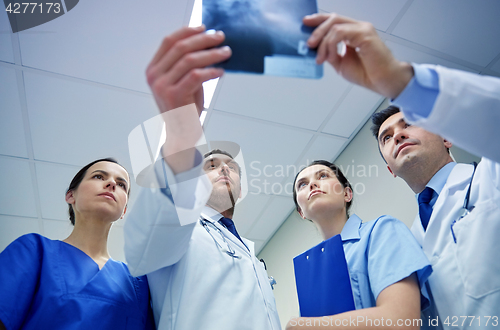 Image of group of doctors looking at x-ray scan image