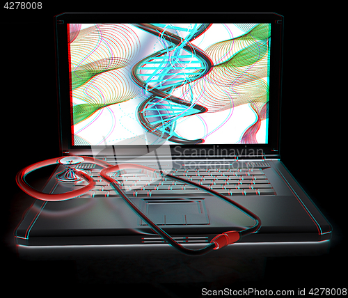 Image of silver laptop diagnosis with stethoscope. 3D illustration. Anagl