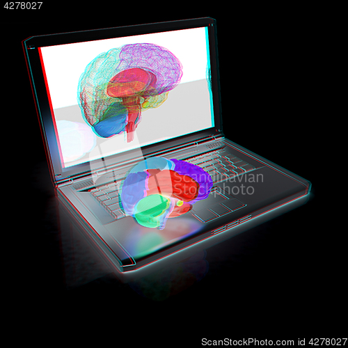 Image of creative three-dimensional model of real human brain and scan on