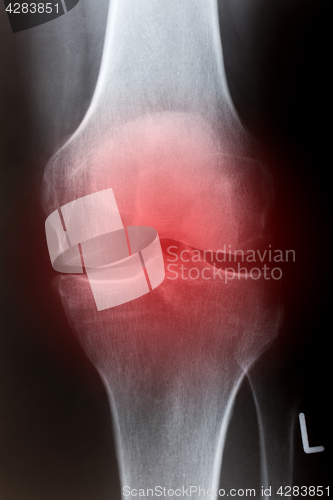 Image of Human knee in front