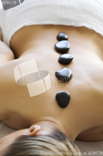 Image of hot stone therapy