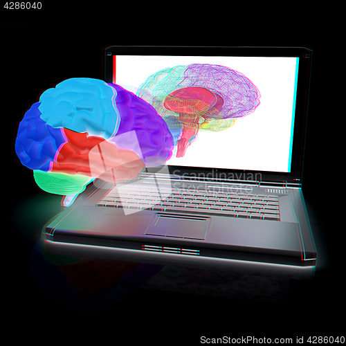 Image of creative three-dimensional model of real human brain and scan on