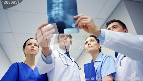 Image of group of doctors looking at x-ray scan image