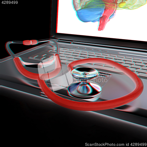 Image of Laptop, brain and Stethoscope. 3d illustration. Anaglyph. View w