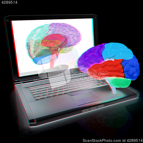 Image of creative three-dimensional model of real human brain and scan on