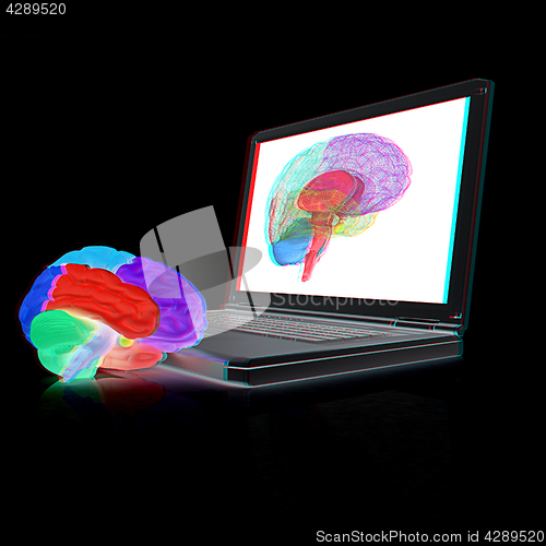 Image of creative three-dimensional model of real human brain and scan on