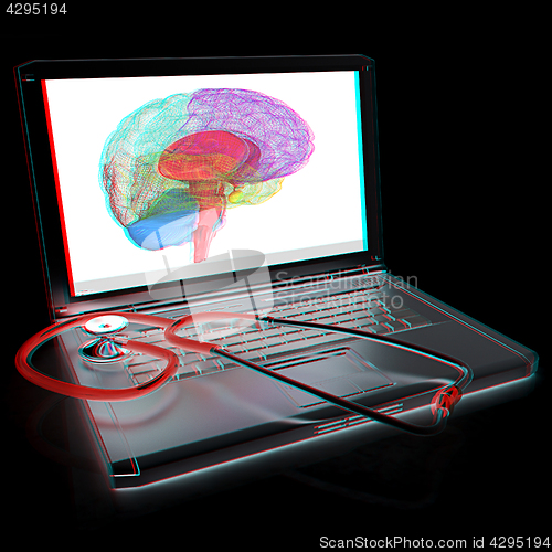 Image of Laptop, brain and Stethoscope. 3d illustration. Anaglyph. View w