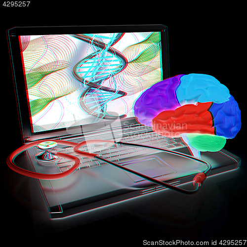 Image of Laptop, brain and Stethoscope. 3d illustration. Anaglyph. View w