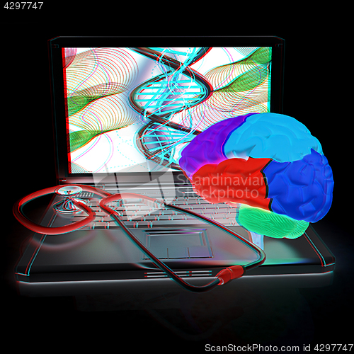 Image of Laptop, brain and Stethoscope. 3d illustration. Anaglyph. View w