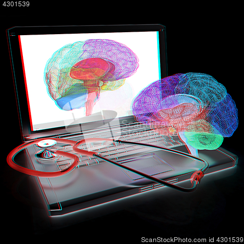 Image of Laptop, brain and Stethoscope. 3d illustration. Anaglyph. View w