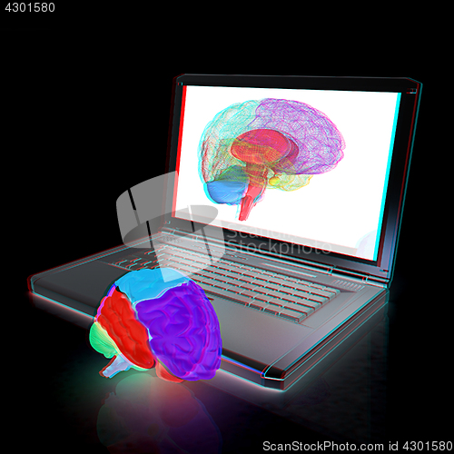 Image of creative three-dimensional model of real human brain and scan on