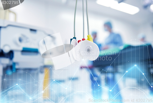 Image of electrodes at hospital ward or operating room