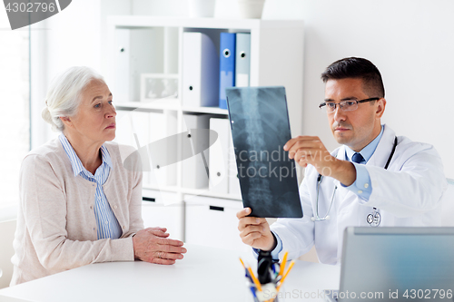 Image of senior woman and doctor with x-ray at hospital