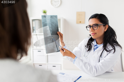 Image of doctor with x-ray of spine and patient at hospital