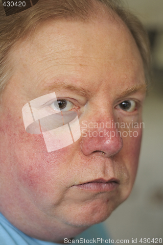 Image of male expression