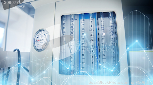 Image of anesthesia machine at hospital operating room