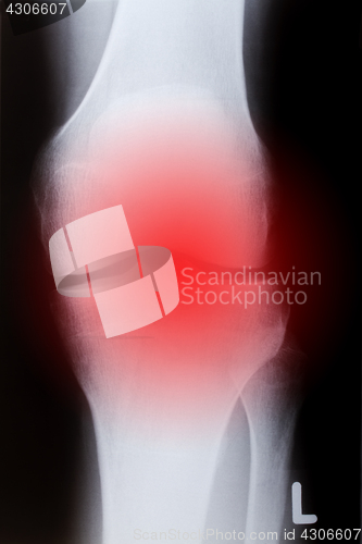 Image of Human knee in front