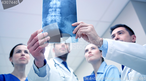 Image of group of medics with spine x-ray scan at hospital